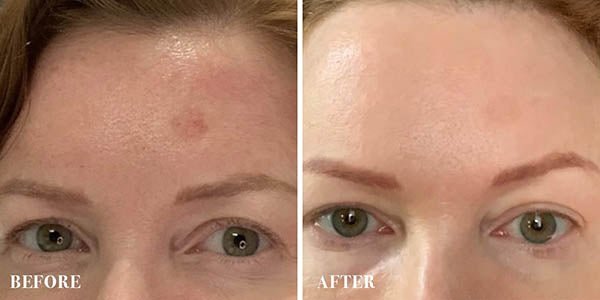 HOW TO AVOID PIGMENTATION CAUSED BY AGEING - Cult51